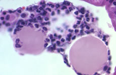Immunology Immunology